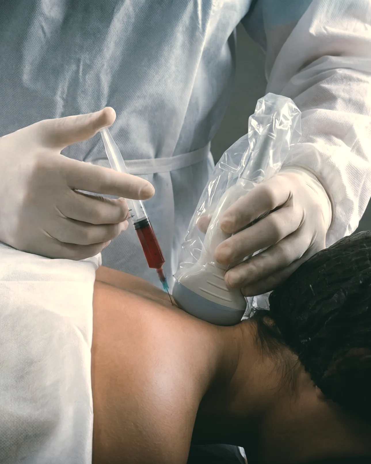 CORTEXIL PRP терапия